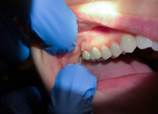 Best Same-Day Emergency Dental Services in Broxton, GA