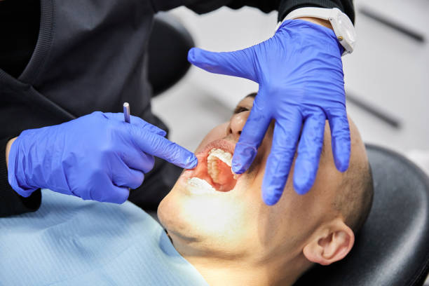 Best Emergency Tooth Extraction in Broxton, GA